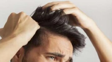 4 أسباب لزيادة قشرة الشعر في الصيف.. نصائح فعّالة للتخلص منها – منوعات